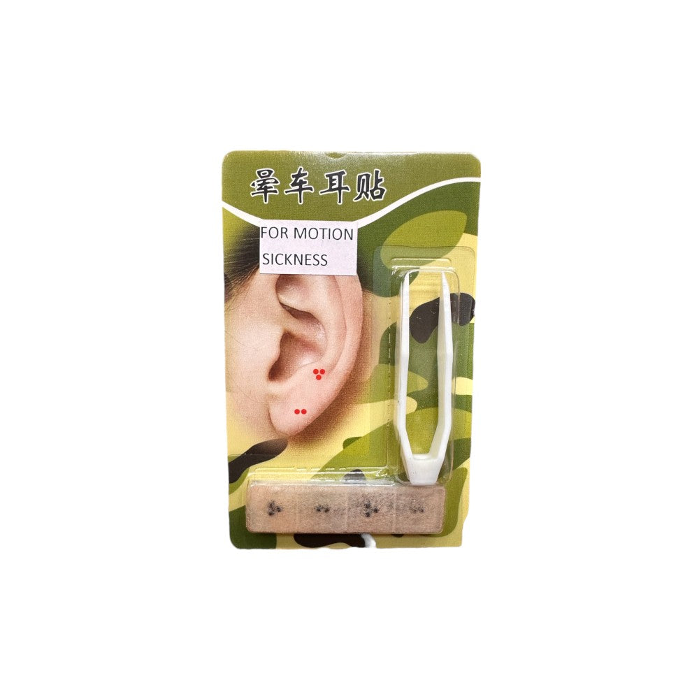 PROTOCOLO DE AURICULOTERAPIA PARA MAREOS POR MOVIMIENTO